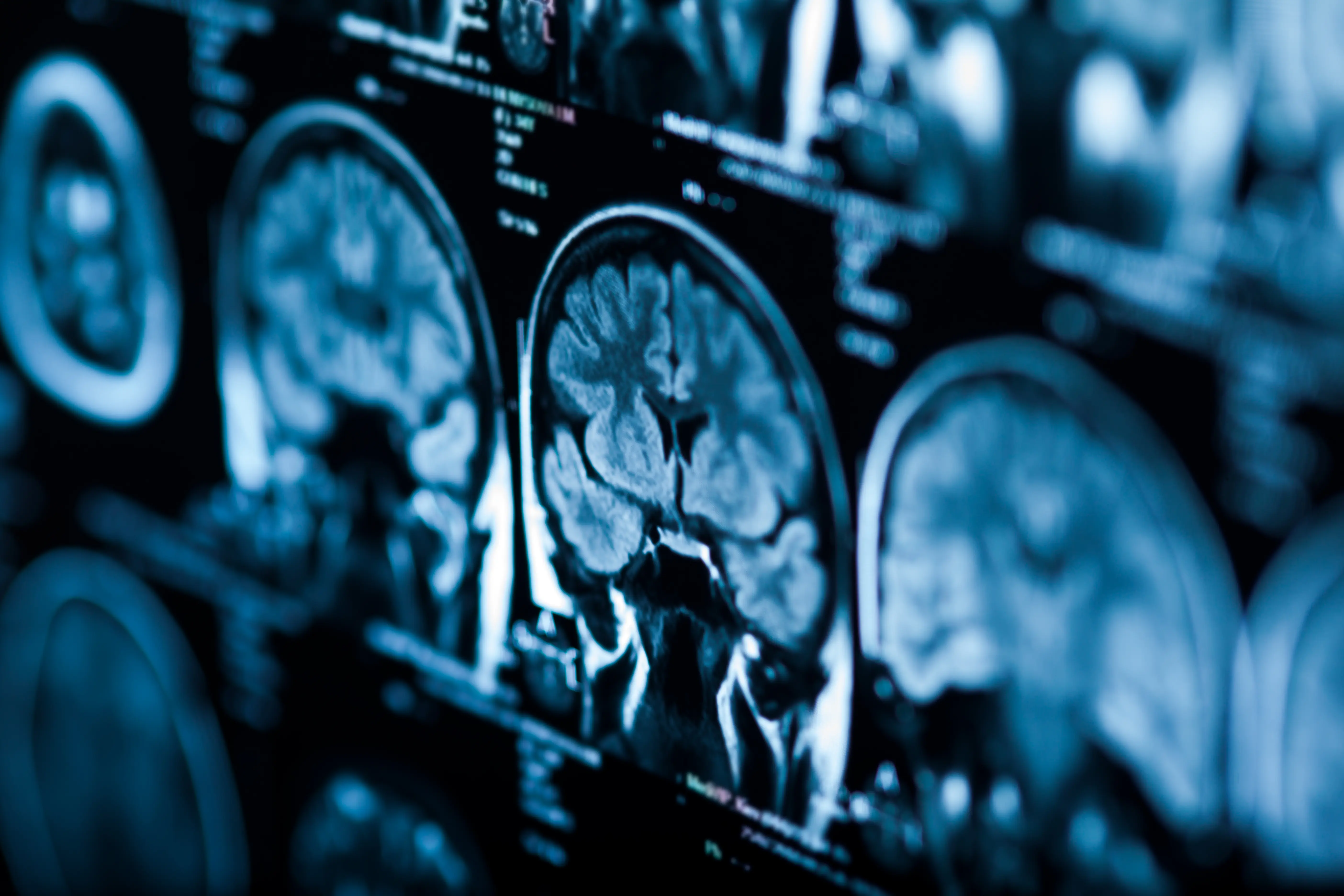 The X Ray Of The Human Brain